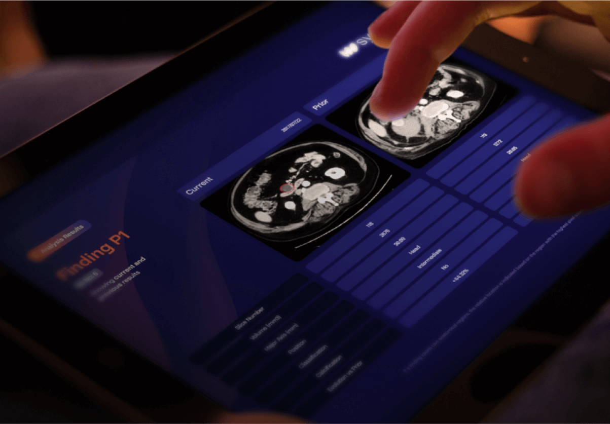 Sabadell BStartup Sycai Medical